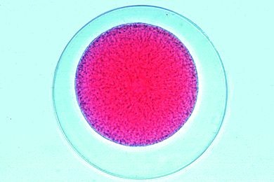 Mikropräparat - Psammechinus, befruchtete Eier