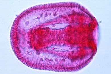 Mikropräparat - Psammechinus, Blastula, fortgeschrittene Gastrulation