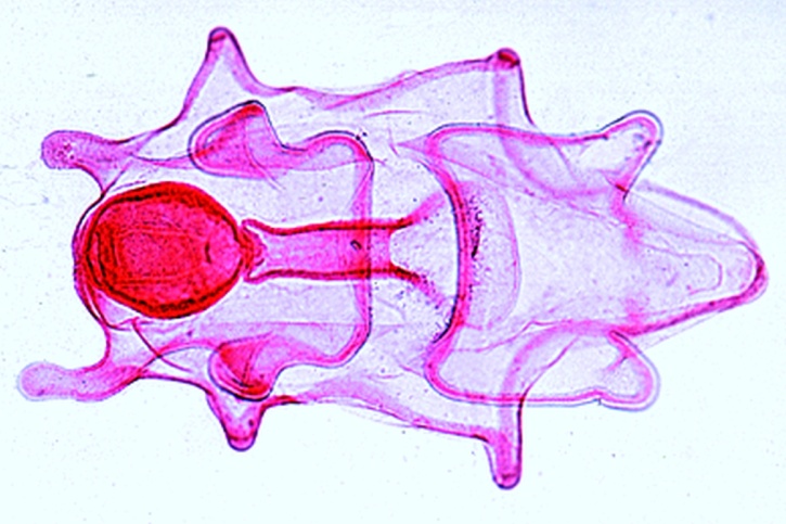 Mikropräparat - Asterias, späte Bipinnaria Larve, total