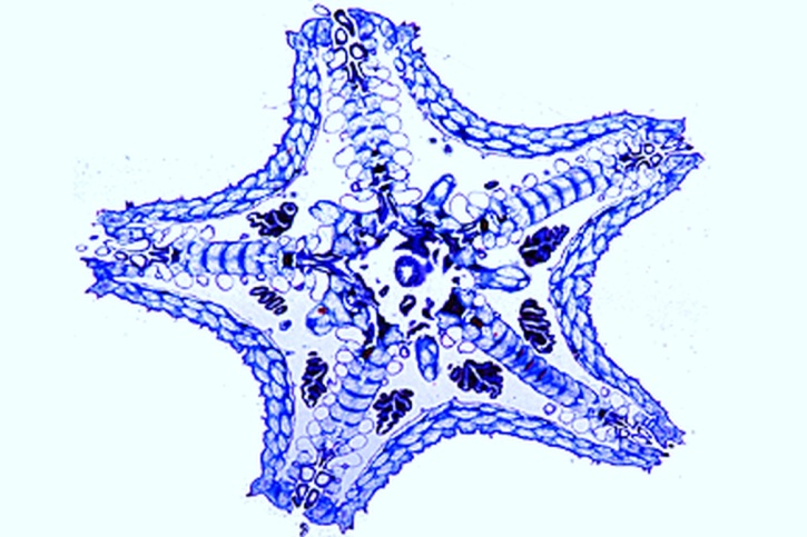 Mikropräparat - Asterias, junger Seestern, total