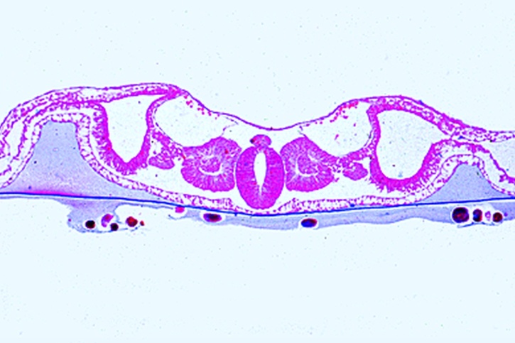 Mikropräparat - Huhn Keim 48h. Querschnitt mit Neuralrohr, Chorda, Differenzierungsvorgänge im Mesoderm