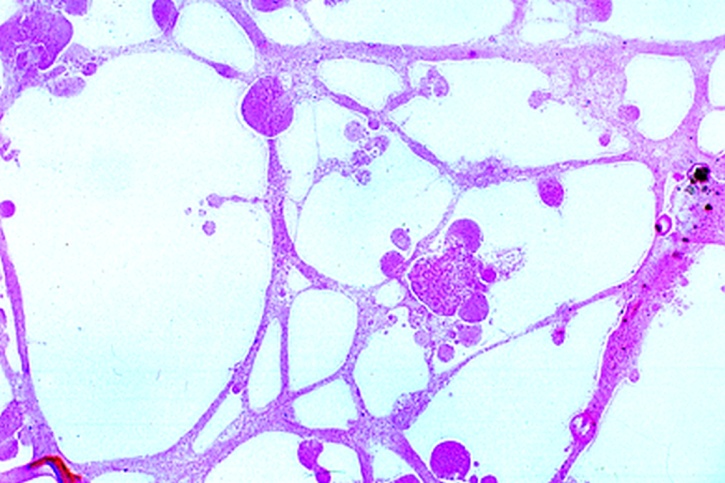 Mikropräparat - Myxoflagellaten, Myxamöben und junge Plasmodien eines Schleimpilzes, total *