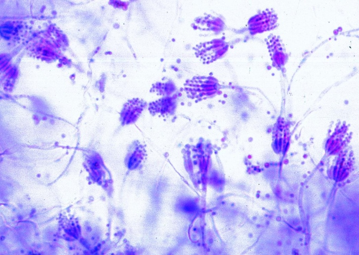 Mikropräparat - Penicillium, Pinselschimmel, Myzel und Konidiophoren total