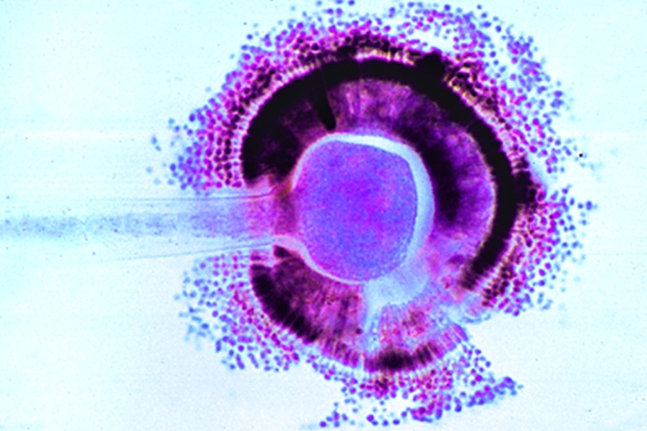 Mikropräparat - Aspergillus, Gießkannenschimmel, Mycel mit Sporangien, total