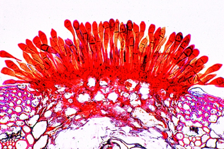 Mikropräparat - Puccinia graminis, Teleutosporen auf Weizenhalm, quer