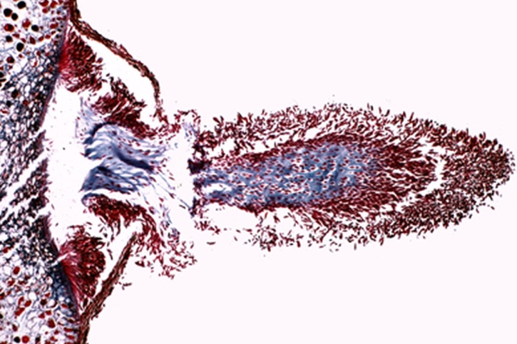 Mikropräparat - Gymnosporangium sabinae, Birnenrost, Teleutosporen auf Juniperus, quer