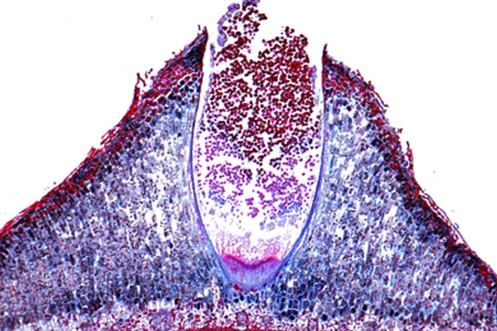 Mikropräparat - Gymnosporangium sabinae, Aezidien am Blatt quer