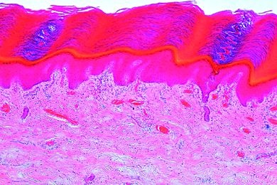 Mikropräparat - Mehrschichtiges, verhorntes Plattenepithel im Schnitt durch die Körperhaut des Menschen