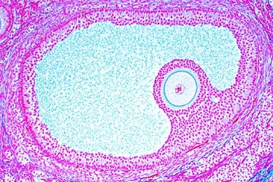 Mikropräparat - Eierstock der Katze, quer, Graafscher Follikel mit Cumulus oviger und Eizelle