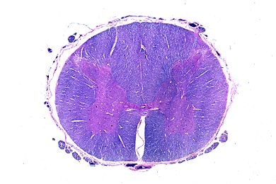 Mikropräparat - Rückenmark vom Menschen, Lumbalregion quer