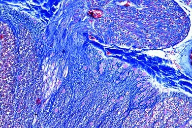Mikropräparat - Sympathisches Ganglion, quer, Multipolare Nervenzellen