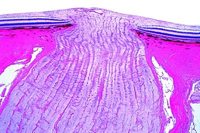 Mikropräparat - Sehnerv vom Rind längs, mit Eintritt in die Retina