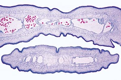 Mikropräparat - Taenia saginata, Proglottiden mehrerer verschiedener Reifestadien, quer