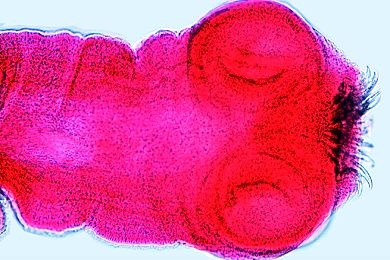 Mikropräparat - Taenia solium, Scolex total