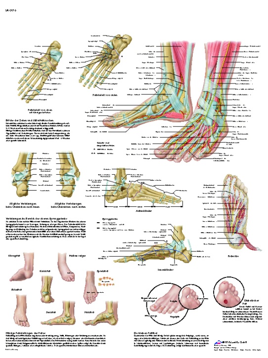 Anatomische Lehrtafel, Fuß und Fußgelenke - Anatomie und Pathologie