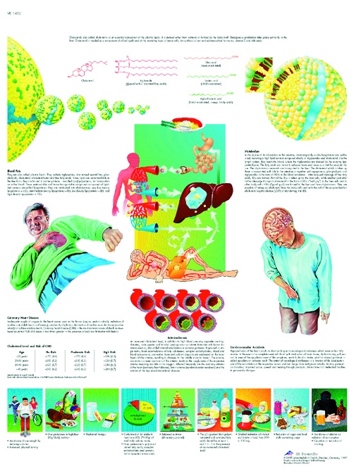 Anatomische Lehrtafel, Cholesterin