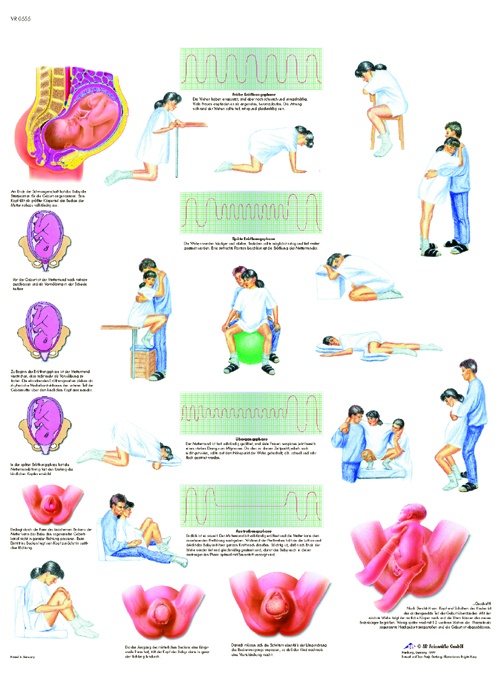 Anatomische Lehrtafel, Die Geburt