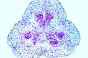 Mikropräparat - Lilium, Lilie, Fruchtknoten quer, Embryosack